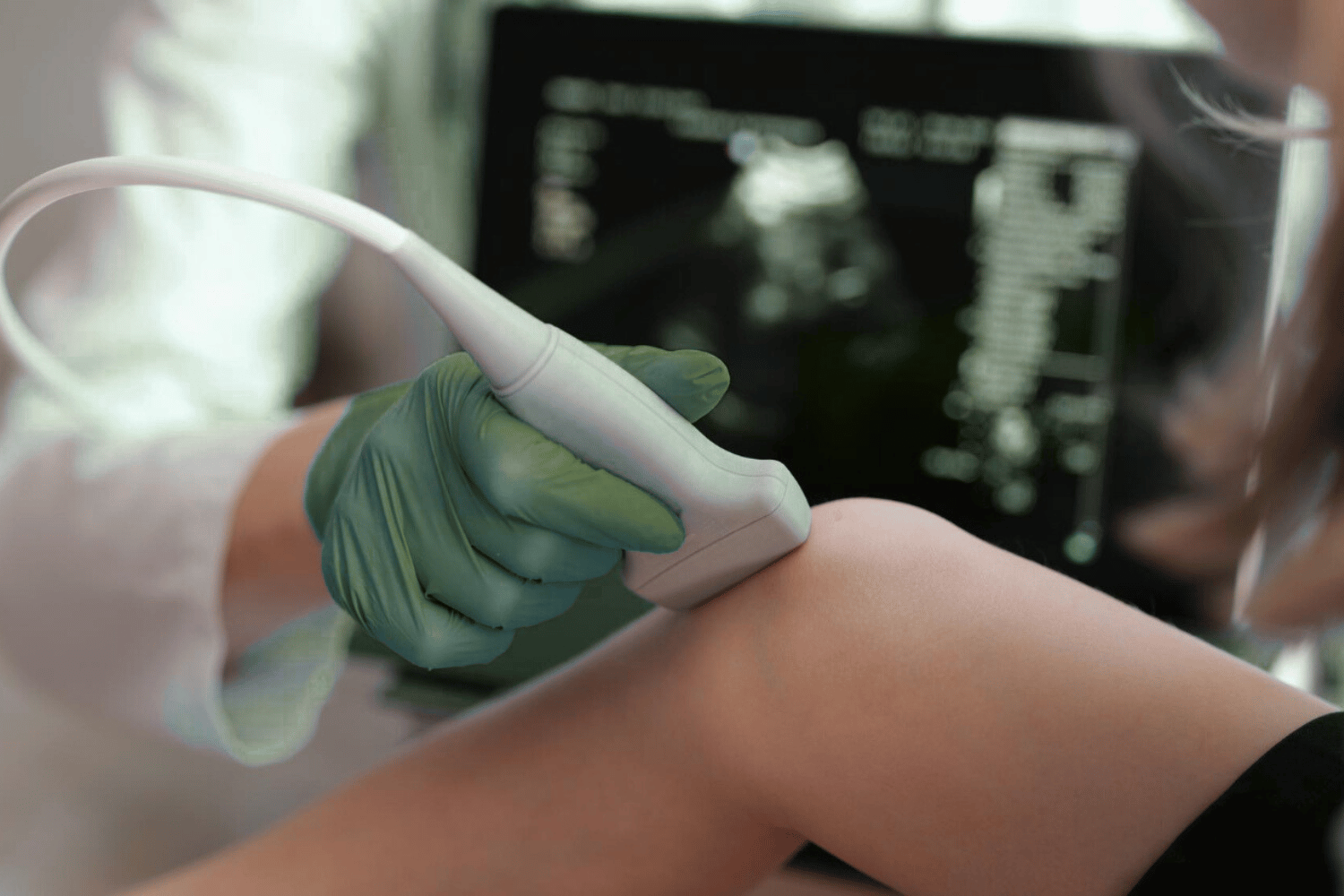 ecografie de tesuturi moi